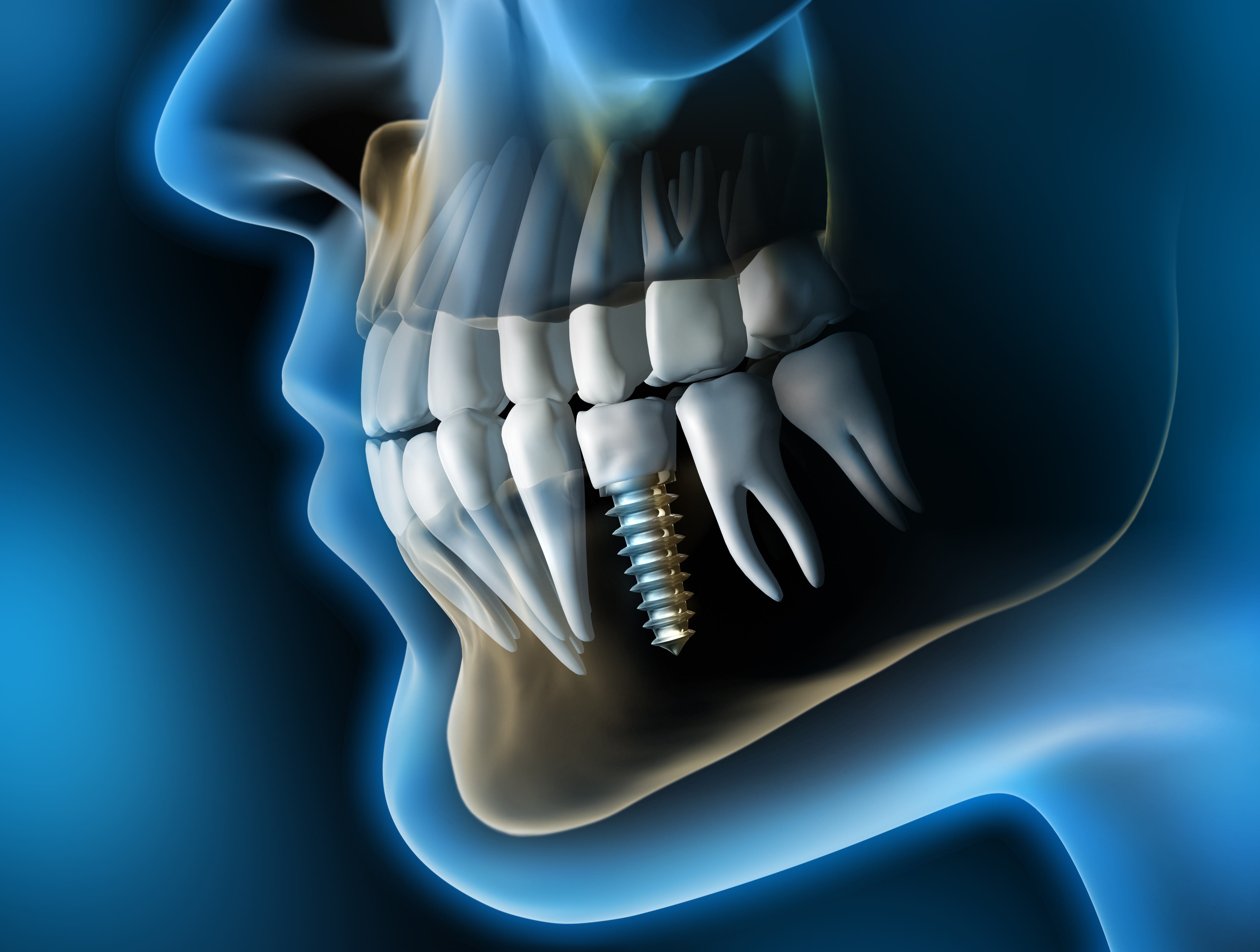 Woman sharing healthy smile after dental checkup and teeth cleaning